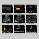 Ecografo Color-Doppler portatile CHISON ECO6 - senza sonde