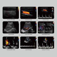 Ecografo Color-Doppler portatile CHISON ECO6 - senza sonde