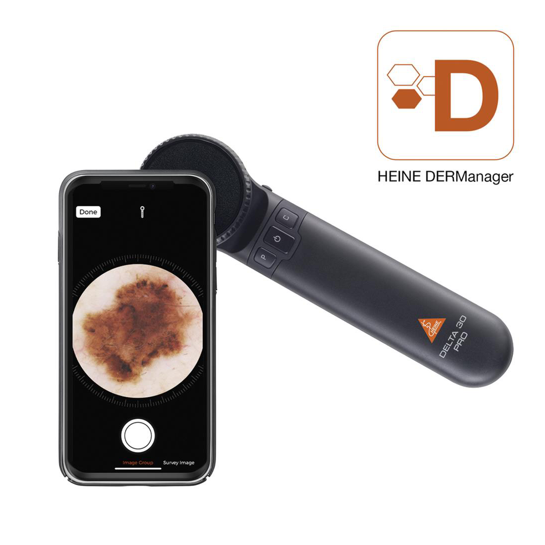 Dermatoscopio HEINE DELTA 30 PRO - K-235.28.305