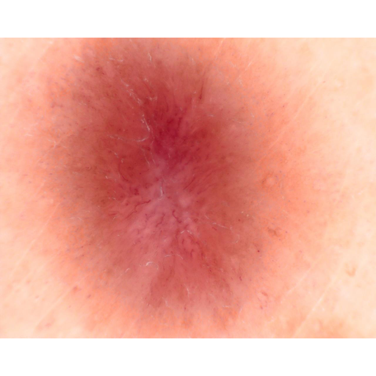 Dermatoscopio Mic-Fi - WI-FI/USB con filtro polarizzato