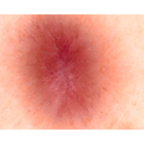 Dermatoscopio Mic-Fi - WI-FI/USB con filtro polarizzato