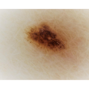 Dermatoscopio Mic-Fi - WI-FI/USB con filtro polarizzato