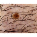 Dermatoscopio Mic-Fi - WI-FI/USB con filtro polarizzato e Software