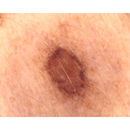 Dermatoscopio Mic-Fi - WI-FI/USB con filtro polarizzato e Software