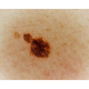 Dermatoscopio Mic-Fi - WI-FI/USB con filtro polarizzato e Software