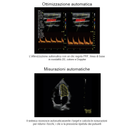 Ecografo Color-Doppler portatile VINNO 5 con Sonda Lineare e Phased-Array