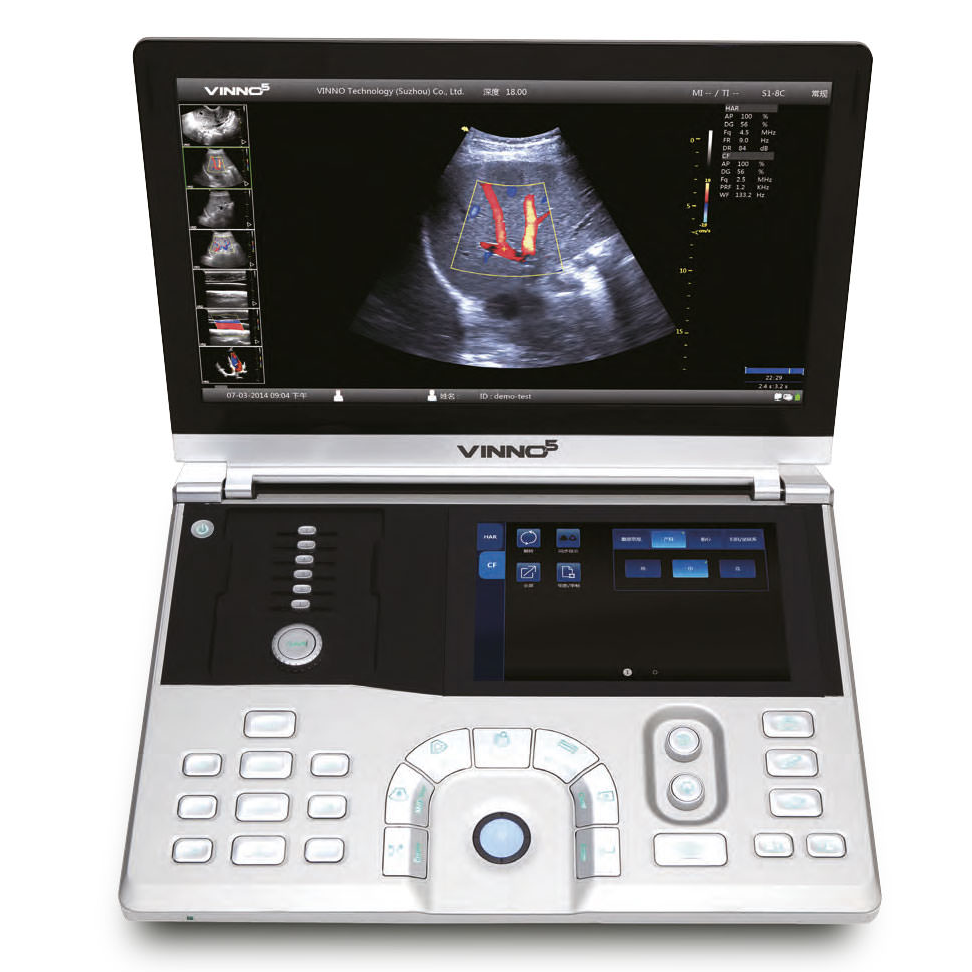 Ecografo Color-Doppler portatile VINNO 5 con Sonda Lineare e Phased-Array