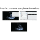 Ecografo Color-Doppler portatile VINNO A6 con Sonda Lineare e Phased-Array