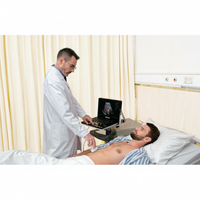 Ecografo Color-Doppler portatile VINNO A6 con Sonda Lineare e Phased-Array