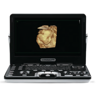 Ecografo Color-Doppler portatile VINNO A6 con Sonda Lineare e Phased-Array