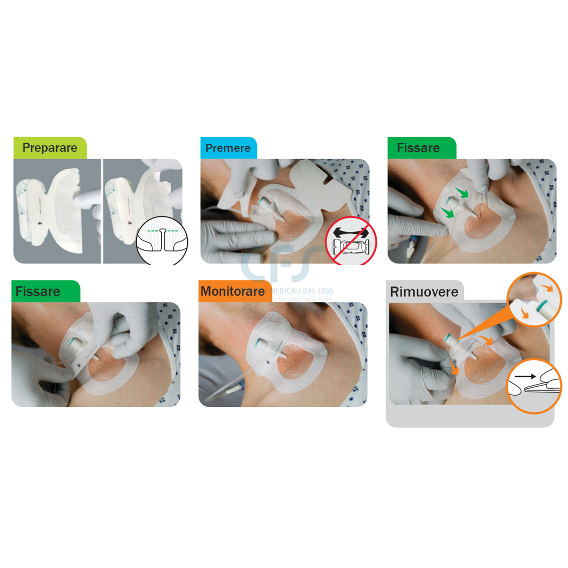 Medicazione adesiva sterile per fissaggio 3M TEGADERM I.V. ADVANCED cm 8,5 x 11,5 (conf. 50 pz.)