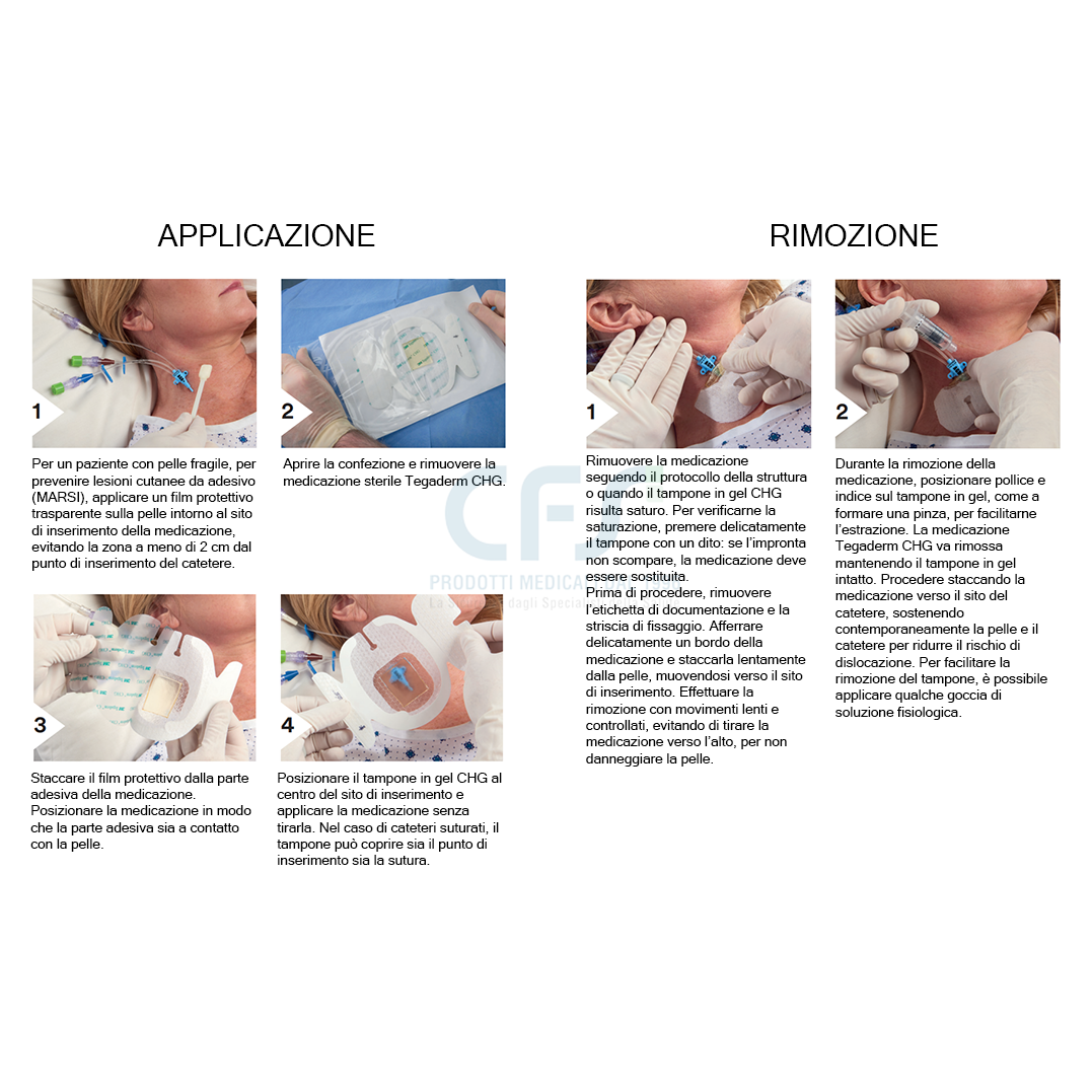 Medicazione adesiva sterile per fissaggio 3M TEGADERM CHG cm (conf. 25 pz.)
