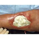 Medicazione in alginato di calcio 3M TEGADERM cm 10 x 10 (conf. 10 pz.)