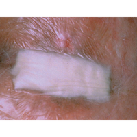 Medicazione in alginato di calcio 3M TEGADERM cm 10 x 10 (conf. 10 pz.)