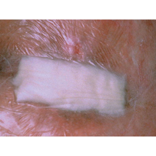 Medicazione in alginato di calcio 3M TEGADERM cm 10 x 10 (conf. 10 pz.)