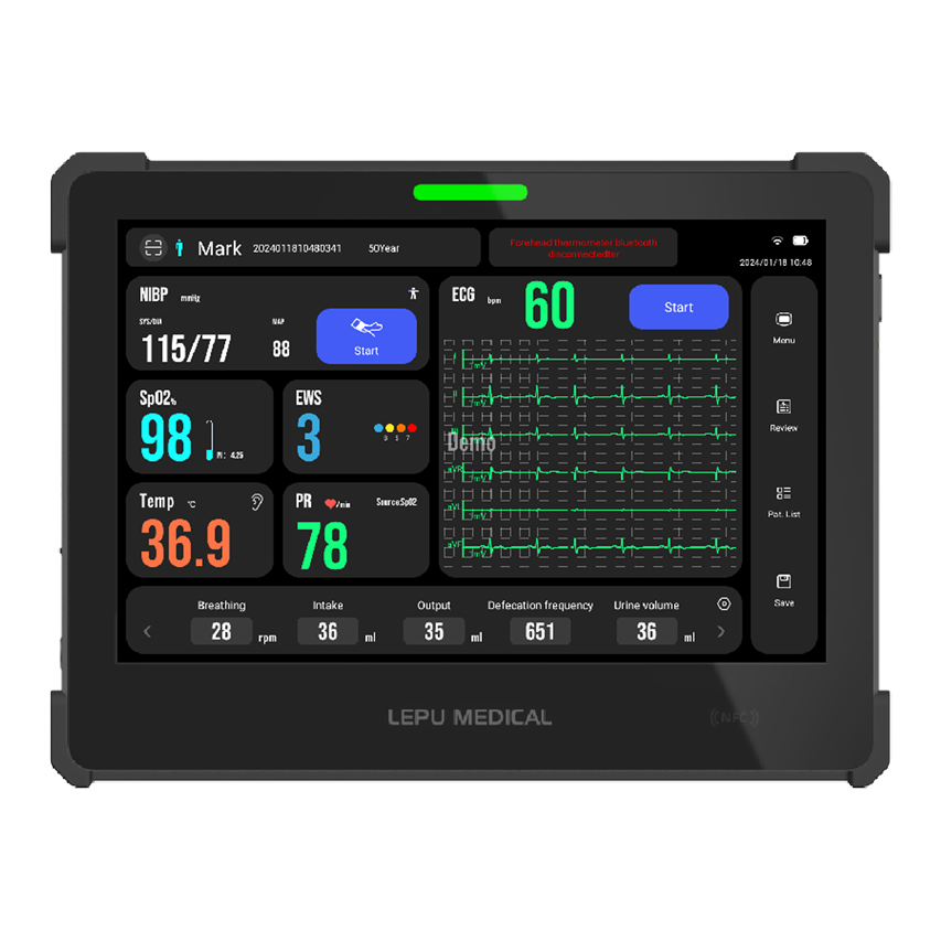 Monitor multiparametrico Tablet AIView VS - SpO2, PR, NIBP, ECG (6 der ...