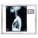 Negativoscopio 36 x 42 a LED con cassonetto