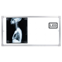 Negativoscopio 97 x 42 a LED con cassonetto