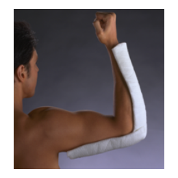 Stecca sintetica per immobilizzazione Dynacast® Prelude cm 10 x 4,6 mt