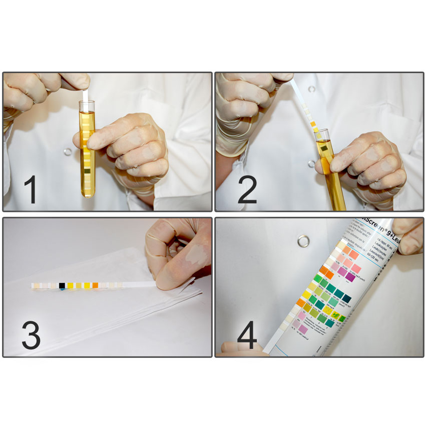 Strisce Urine COMBI SCREEN® 9+LEUKO PLUS - 9+1 parametri (100 strisce)