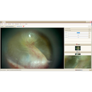 Video Otoscopio RESONANCE RE-VO2 + Software PC