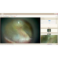Video Otoscopio RESONANCE RE-VO2 + Software PC