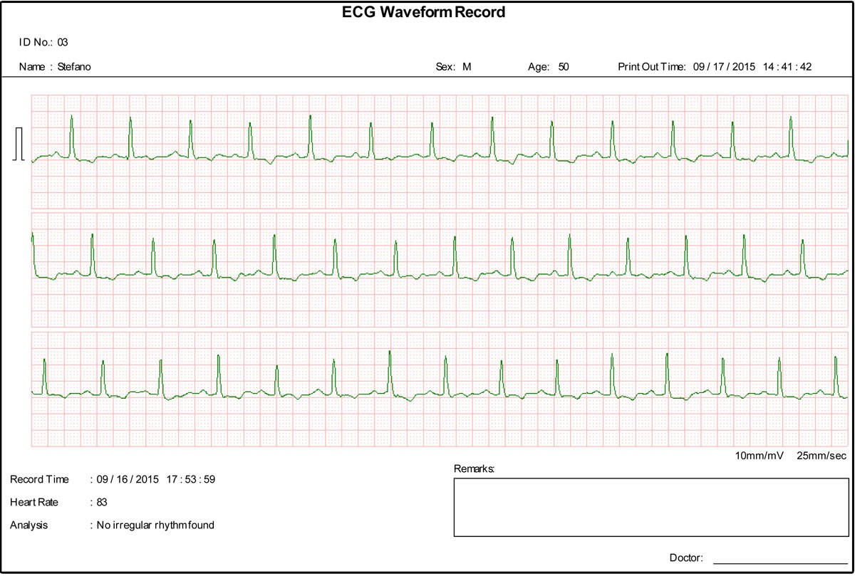 Ecg palmare Cardio B - 1 canale / 17 referti