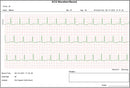 Ecg palmare Cardio B - 1 canale / 17 referti