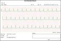 Ecg palmare Cardio B - 1 canale / 17 referti
