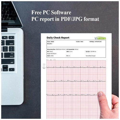 Monitor multiparametrico portatile CHECKME LITE Wireless - ECG e SpO2