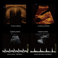 Ecografo Eco-Doppler portatile CHISON ECO2 - senza sonde