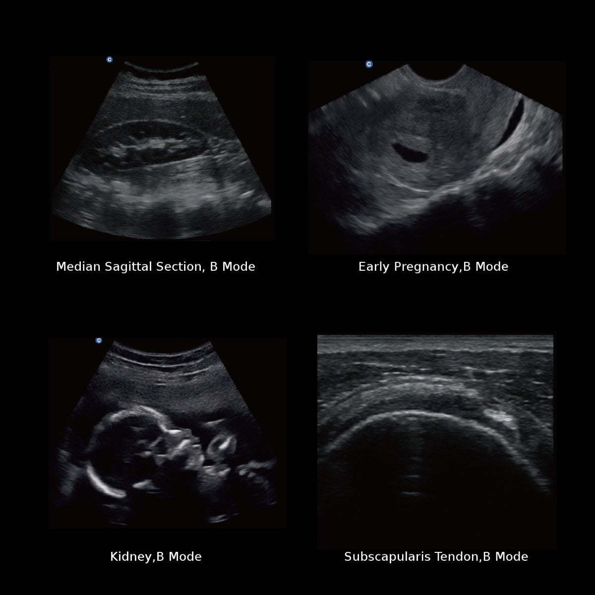 Ecografo Eco-Doppler portatile CHISON ECO2 - senza sonde