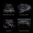 Ecografo Eco-Doppler portatile CHISON ECO2 - senza sonde