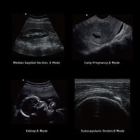Ecografo Eco-Doppler portatile CHISON ECO2 - senza sonde