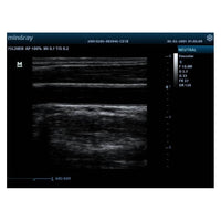 Ecografo portatile MINDRAY DP10 nuova versione - senza sonde