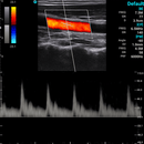 Ecografo Color-Doppler palmare SonoEye P2 con Sonda Lineare 7,5 MHz