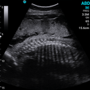 Ecografo Color-Doppler palmare SonoEye P5 con Sonda Convex 3,5 MHz