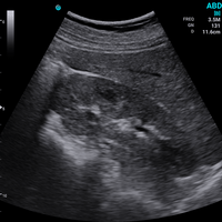 Ecografo Color-Doppler palmare SonoEye P5 con Sonda Convex 3,5 MHz