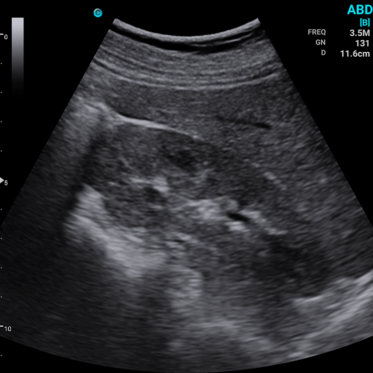 Ecografo Color-Doppler palmare SonoEye P5 con Sonda Convex 3,5 MHz
