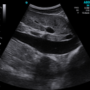 Ecografo Color-Doppler palmare SonoEye P5 con Sonda Convex 3,5 MHz