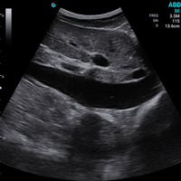 Ecografo Color-Doppler palmare SonoEye P5 con Sonda Convex 3,5 MHz
