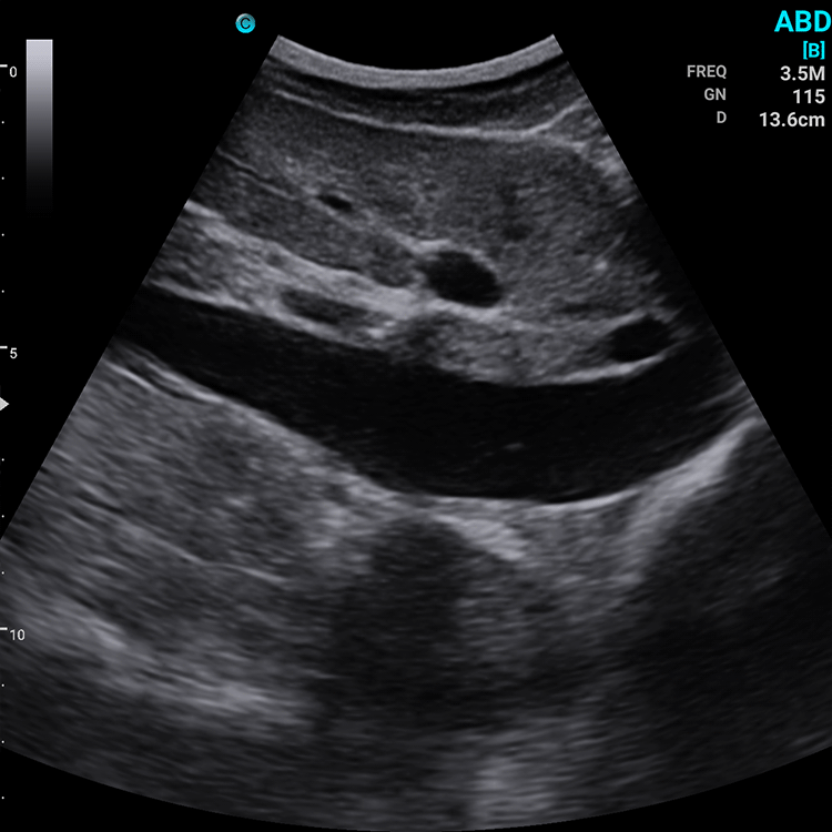 Ecografo Color-Doppler palmare SonoEye P5 con Sonda Convex 3,5 MHz