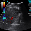 Ecografo Color-Doppler palmare SonoEye P5 con Sonda Convex 3,5 MHz