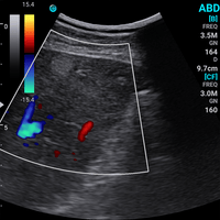 Ecografo Color-Doppler palmare SonoEye P5 con Sonda Convex 3,5 MHz