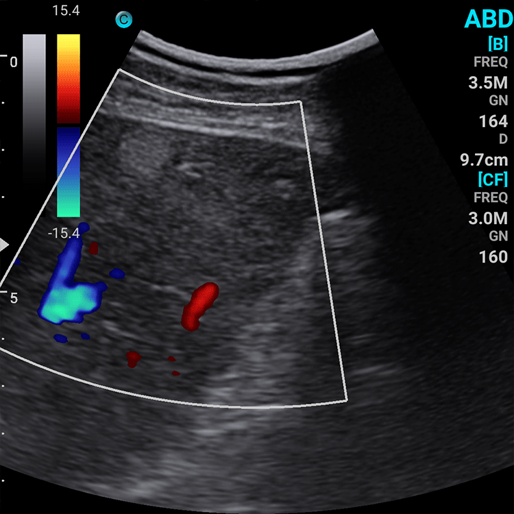 Ecografo Color-Doppler palmare SonoEye P5 con Sonda Convex 3,5 MHz