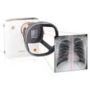 Set camera a raggi X REMEX KA6 + detector 43 x 43 cm + laptop con software