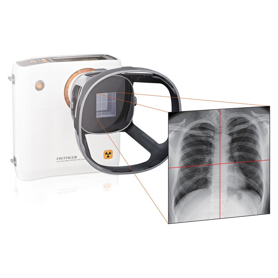 Set camera a raggi X REMEX KA6 + detector 43 x 43 cm + laptop con software