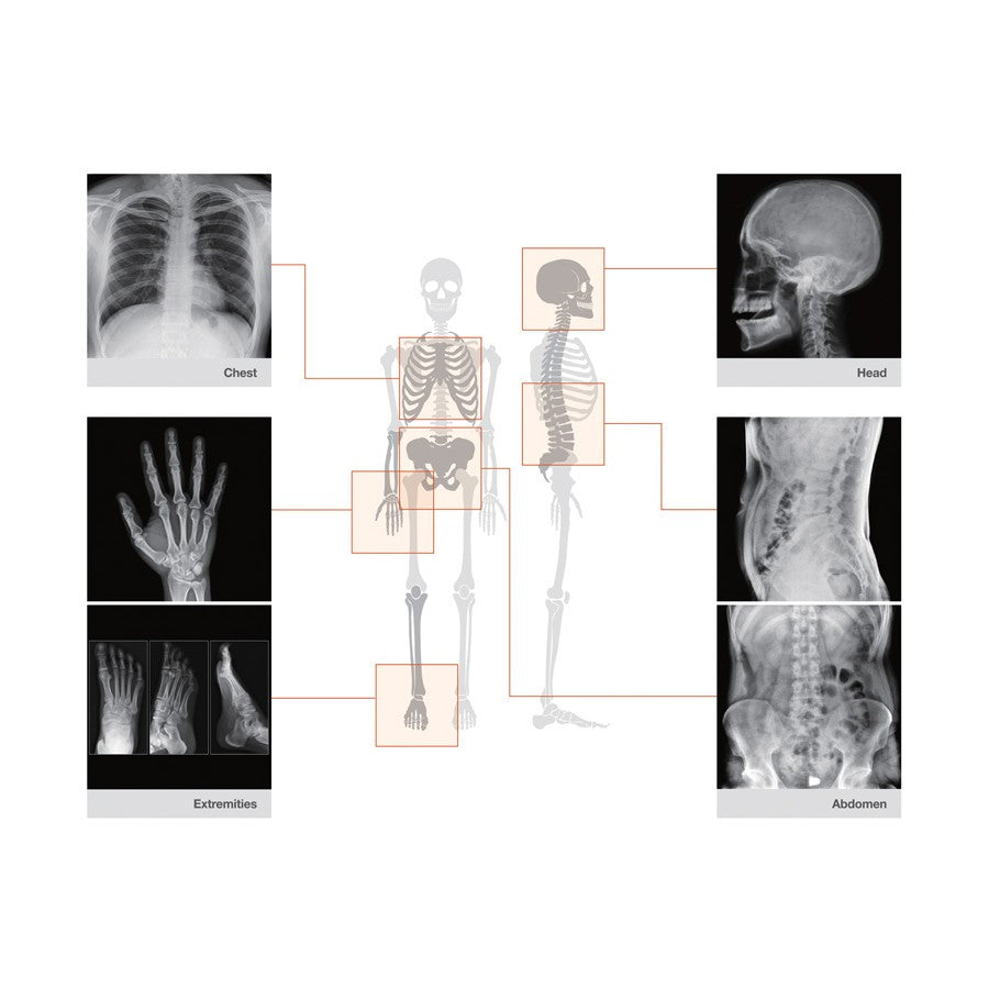Set camera a raggi X REMEX KA6 + detector 43 x 43 cm + laptop con software