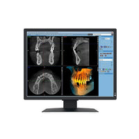 Monitor medicale da consultazione EIZO MX217-SB