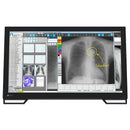 Monitor medicale da consultazione EIZO MS236WT-A